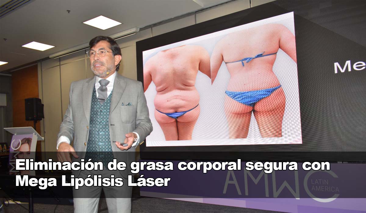 Quítate la grasa corporal de forma segura con Mega Lipólisis Láser