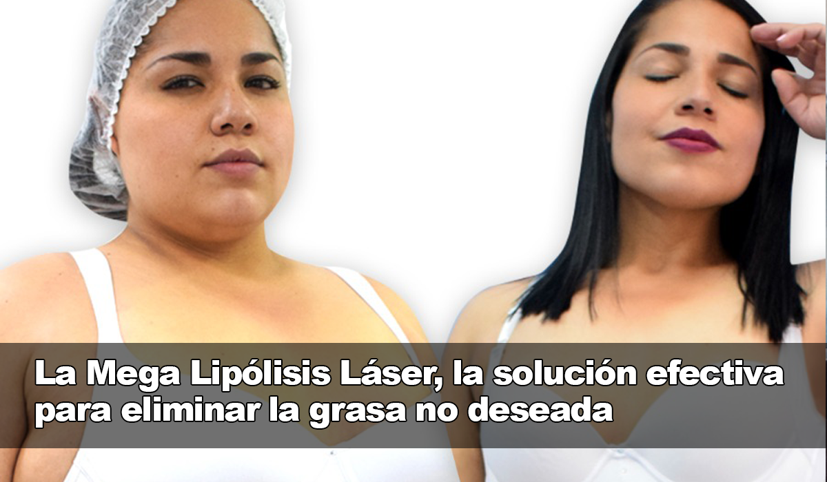 La Mega Lipólisis Láser: la mejor elección para eliminar la grasa sin temor